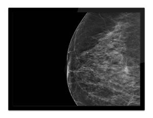 RSNA 2025 LP_Image-Based Risk-1