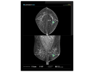 RSNA 2025 LP_MMG & DBT-1