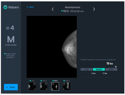 high pressure scale-1